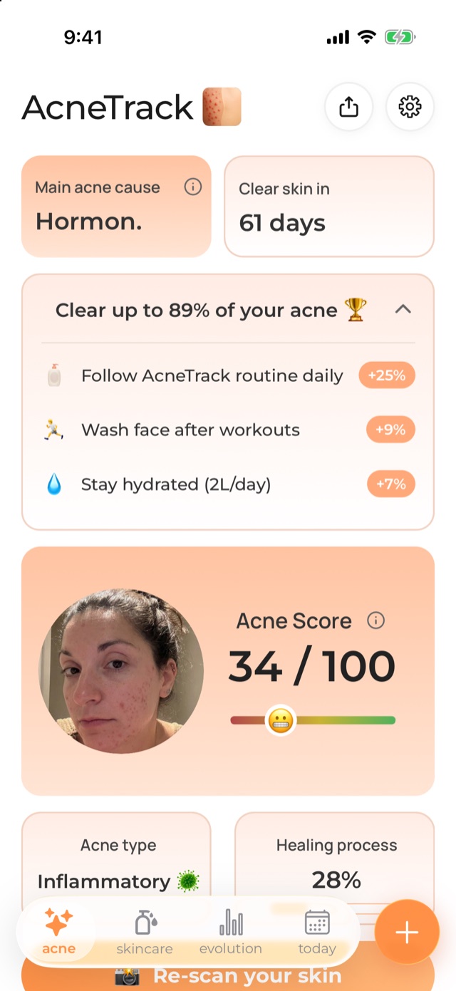 AcneTrack plan: main cause, goal date and acne score